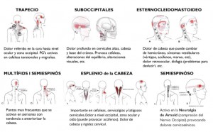 Puntos Gatillo de algunos músculos cervicales y las regiones de su dolor referido asociado a cefaleas tensionales